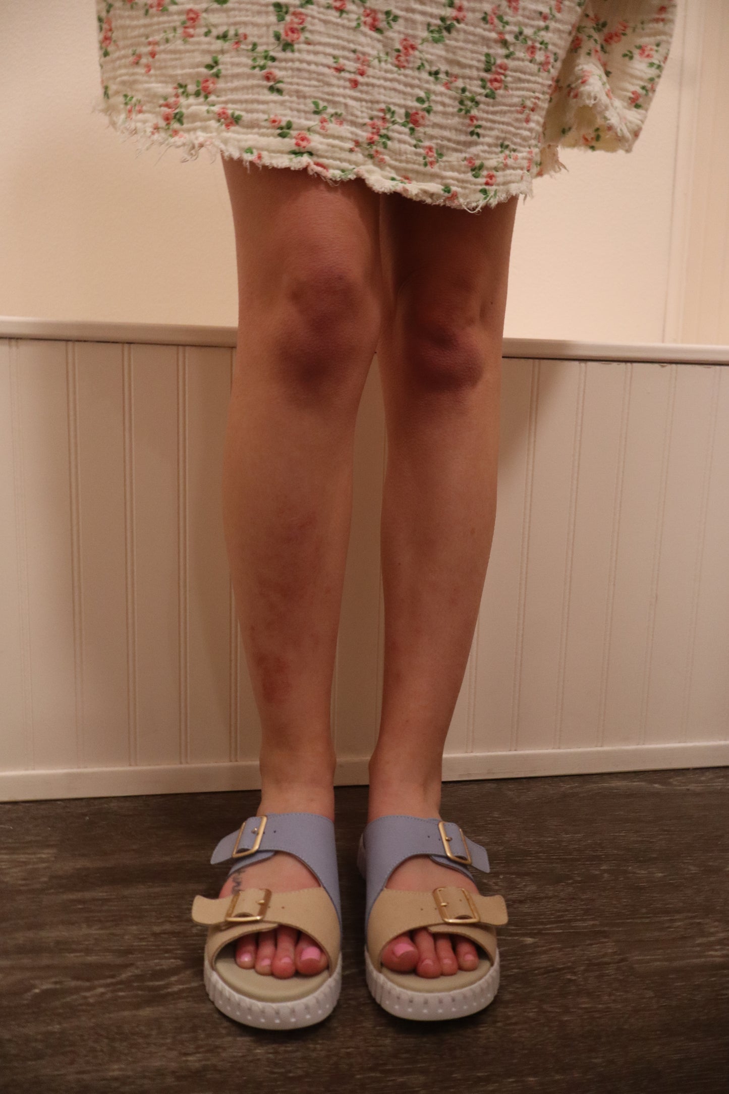 The Tulip Adjustable Sandals w/ Buckle - Cornflower Blue