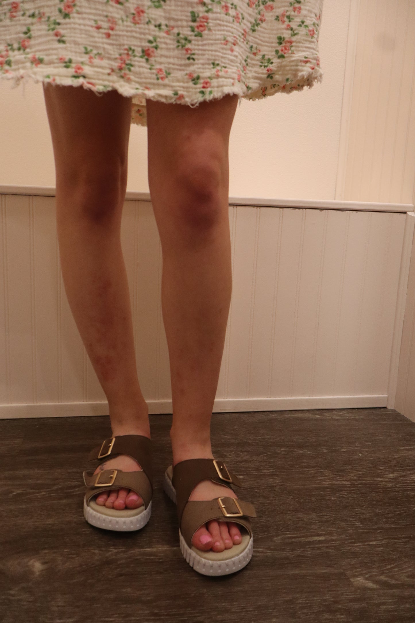The Tulip Adjustable Sandals w/ Buckle - Chestnut